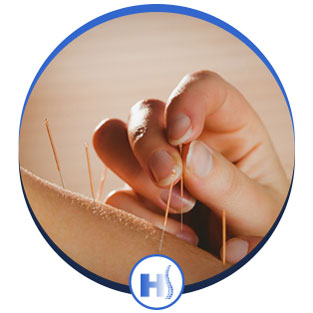 Acupuncture Services in Jersey City, NJ