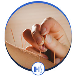 Acupuncture Services in Jersey City, NJ