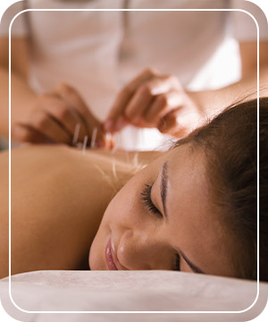 Acupuncture Services in Jersey City, NJ